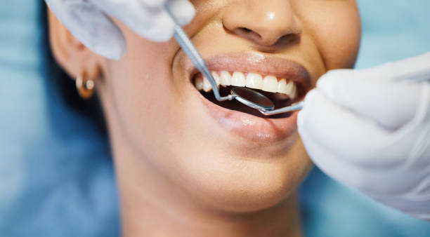 Best Emergency Root Canal Treatment in Fairview, NC
